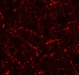 Anti-MIP1 beta antibody used in IHC (Paraffin sections) (IHC-P). GTX17201