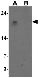 Anti-HE4 antibody used in Western Blot (WB). GTX17207