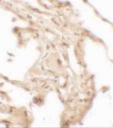Anti-HE4 antibody used in IHC (Paraffin sections) (IHC-P). GTX17207