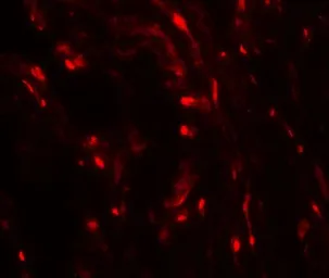 Anti-HE4 antibody used in IHC (Paraffin sections) (IHC-P). GTX17207