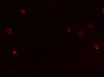 Anti-CD160 antibody used in Immunocytochemistry/ Immunofluorescence (ICC/IF). GTX17209