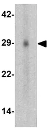 Anti-GLIPR1 antibody used in Western Blot (WB). GTX17212