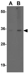 Anti-SHBG antibody used in Western Blot (WB). GTX17222