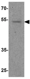 Anti-FOXG1 antibody used in Western Blot (WB). GTX17231