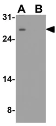 Anti-VTI1B antibody used in Western Blot (WB). GTX17253