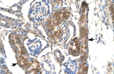 Anti-SLC17A2 antibody, Internal used in IHC (Paraffin sections) (IHC-P). GTX17427