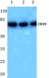 Anti-CD39 antibody used in Western Blot (WB). GTX17496
