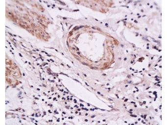 Anti-CD62E antibody used in IHC (Paraffin sections) (IHC-P). GTX17548