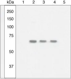 Anti-NFkB p65 (phospho Ser529) antibody used in Western Blot (WB). GTX17575