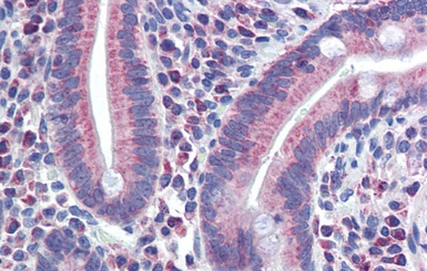Anti-PXR antibody used in IHC (Paraffin sections) (IHC-P). GTX17595