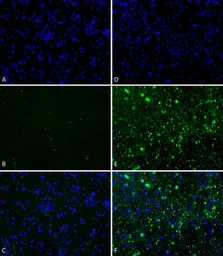 Human alpha Synuclein protein (Pre-Formed Fibrils). GTX17667-pro