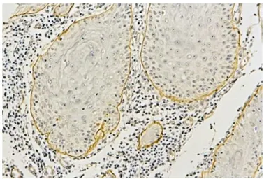 Anti-Laminin alpha 3B antibody [F7] used in IHC (Paraffin sections) (IHC-P). GTX17684