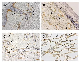 Anti-Laminin alpha 3B antibody [F7] used in IHC (Paraffin sections) (IHC-P). GTX17684