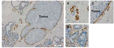Anti-Laminin 511 antibody [12D] used in IHC (Frozen sections) (IHC-Fr). GTX17688