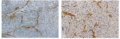 Anti-Laminin 511 antibody [12D] used in IHC (Frozen sections) (IHC-Fr). GTX17688