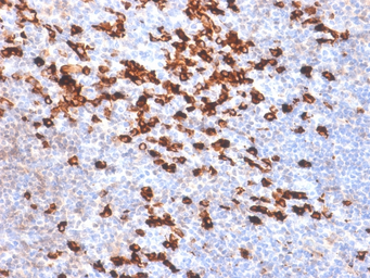 Rabbit Anti-Human kappa light chain antibody [IGKC/1999R]. GTX17709