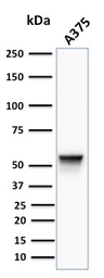 Anti-Vimentin antibody [VM452] used in Western Blot (WB). GTX17723
