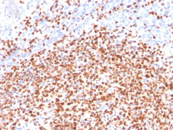 Anti-OCT2 antibody [OCT2/2137] used in IHC (Paraffin sections) (IHC-P). GTX17727