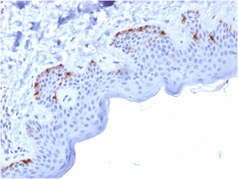 Anti-Melanoma gp100 antibody [PMEL/2037] used in IHC (Paraffin sections) (IHC-P). GTX17772
