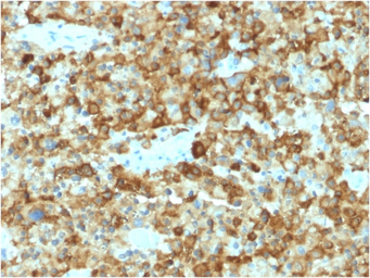 Anti-Melanoma gp100 antibody [PMEL/2037] used in IHC (Paraffin sections) (IHC-P). GTX17772