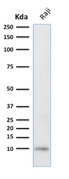 Anti-Ubiquitin antibody [UBB/2122] used in Western Blot (WB). GTX17824