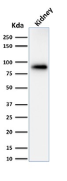 Anti-Calnexin antibody [CANX/1543] used in Western Blot (WB). GTX17859