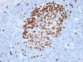 Anti-Ki67 antibody [MKI67/2462] used in IHC (Paraffin sections) (IHC-P). GTX17971