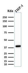 Anti-PU.1 antibody [PU1/2146] used in Western Blot (WB). GTX17997