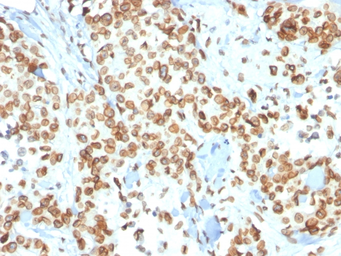 Anti-Emerin antibody [EMD/2167] used in IHC (Paraffin sections) (IHC-P). GTX18054