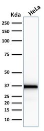 Anti-Emerin antibody [EMD/2167] used in Western Blot (WB). GTX18054