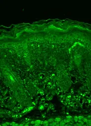 Anti-Rhodopsin antibody [1D4] (Biotin) used in IHC (Paraffin sections) (IHC-P). GTX18143