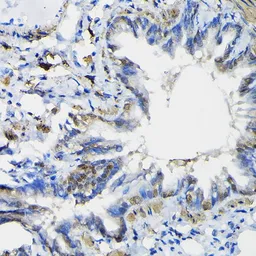Anti-PTEN antibody used in IHC (Paraffin sections) (IHC-P). GTX18153