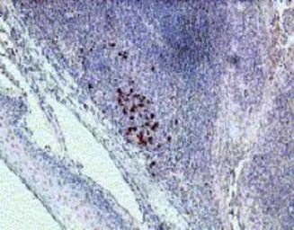 Anti-IL22 Receptor alpha 1 antibody used in Immunohistochemistry (IHC). GTX18568