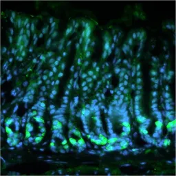 Anti-Calcium Sensing Receptor antibody [5C10, ADD] used in IHC (Frozen sections) (IHC-Fr). GTX19347