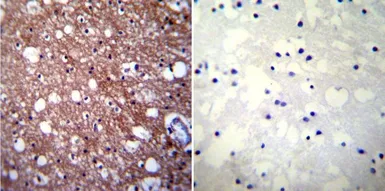 Anti-Calcium Sensing Receptor antibody [5C10, ADD] used in IHC (Paraffin sections) (IHC-P). GTX19347