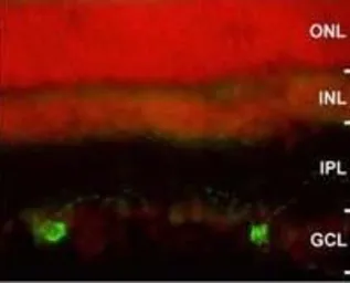 Anti-Melanopsin antibody used in Immunohistochemistry (IHC). GTX19383