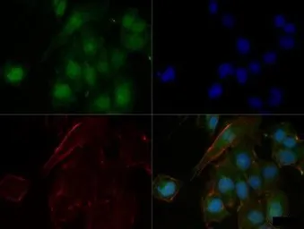 Anti-n-Myc antibody [NMYC-1] used in Immunocytochemistry/ Immunofluorescence (ICC/IF). GTX20057