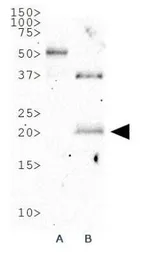 Anti-p19ARF antibody used in Western Blot (WB). GTX20080