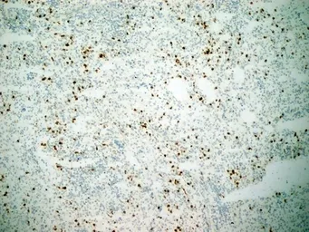 Anti-CD11b antibody [ICRF44] used in IHC (Frozen sections) (IHC-Fr). GTX20183