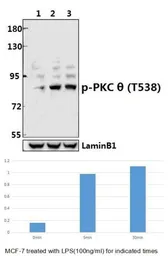Anti-PKC theta (phospho Thr538) antibody used in Western Blot (WB). GTX20304