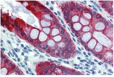 Anti-Cytokeratin 18 antibody [DA-7] used in IHC (Paraffin sections) (IHC-P). GTX20669