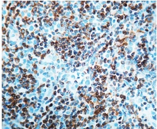Anti-Bcl-2 antibody [124] used in IHC (Paraffin sections) (IHC-P). GTX20694