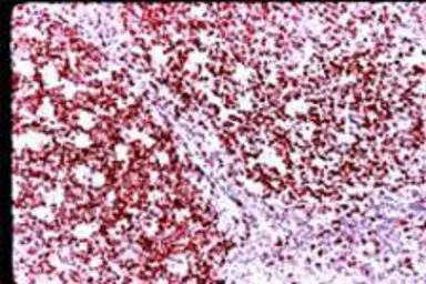 Anti-Ki67 antibody used in IHC (Paraffin sections) (IHC-P). GTX20833