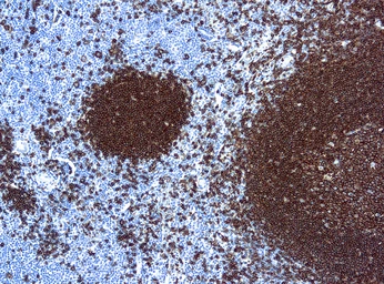 Anti-CD20 antibody [L26] (ready-to-use) used in IHC (Paraffin sections) (IHC-P). GTX20840