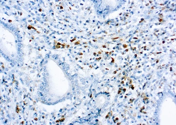 Rabbit Anti-Human kappa light chain antibody (ready-to-use). GTX20940