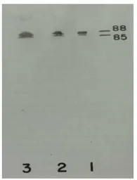 Anti-Plasma Kallikrein 1B antibody [13G11] used in Western Blot (WB). GTX21006