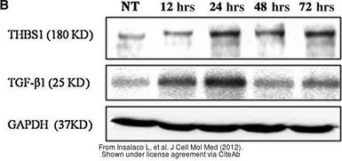 Anti-TGF beta antibody [TB21] used in Western Blot (WB). GTX21279