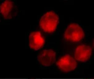 Anti-ADAM10 antibody used in Immunocytochemistry/ Immunofluorescence (ICC/IF). GTX21997