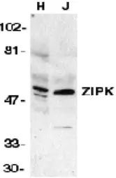 Anti-DAP Kinase 3 antibody used in Western Blot (WB). GTX22057