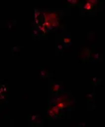 Anti-DcR1 antibody used in Immunocytochemistry/ Immunofluorescence (ICC/IF). GTX22087